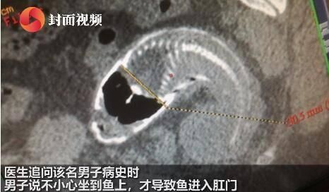 2020年喜感新闻盘点：2020年最佳喜感新闻大合集[多图]图片8